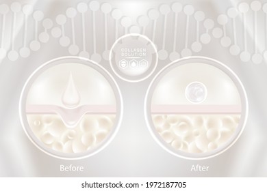 Hyaluronic acid before and after skin solutions, white collagen serum drops with cosmetic advertising background ready to use, illustration vector.