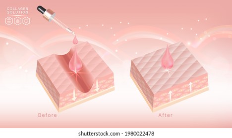 Hyaluronic acid before and after skin solutions ad, pink collagen serum drops with cosmetic advertising background ready to use, illustration vector.