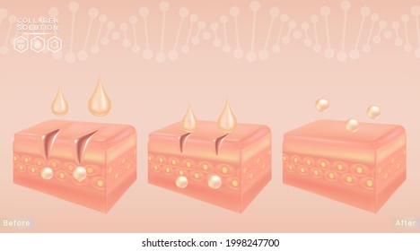 Hyaluronic acid before and after skin solutions ad, orange collagen serum drops with cosmetic advertising background ready to use, illustration vector.