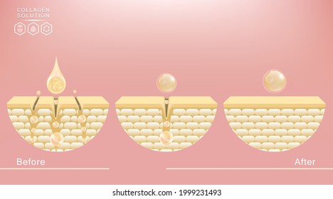 Ácido hialurónico antes y después de la aparición de soluciones cutáneas, el suero de colágeno dorado cae con el fondo publicitario estético listo para usar, vector ilustrativo.