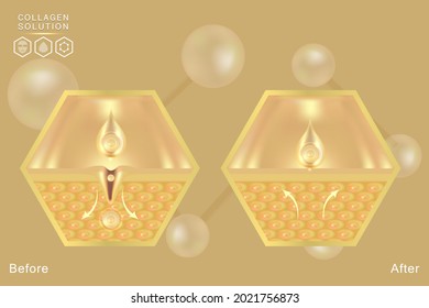 Hyaluronic acid before and after skin solutions ad, gold collagen serum drop with cosmetic advertising background ready to use, illustration vector.