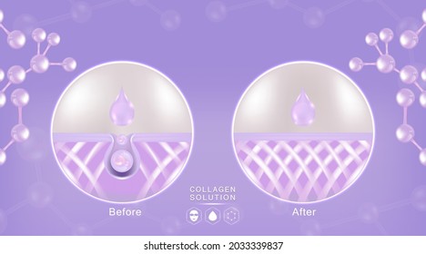 Hyaluronic acid before and after skin solutions ad, purple collagen serum drops with cosmetic advertising background ready to use, illustration vector.