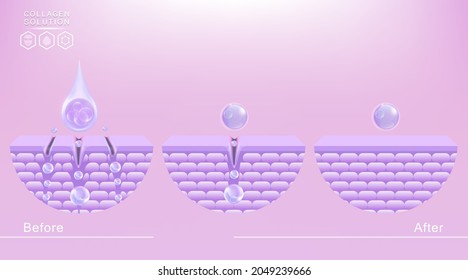 Hyaluronic acid before and after skin solutions ad, purple collagen serum drops, cosmetic advertising background ready to use, illustration vector.