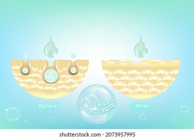 Hyaluronic acid before and after skin solutions ad, blue collagen serum drops with cosmetic advertising background ready to use, illustration vector.