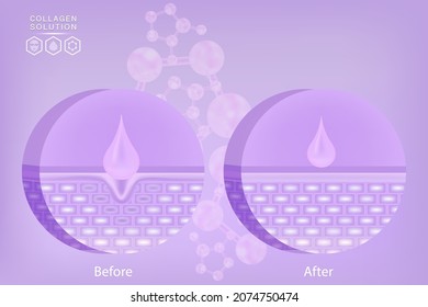 Hyaluronic acid before and after skin solutions ad, purple collagen serum drops with cosmetic advertising background ready to use, illustration vector.