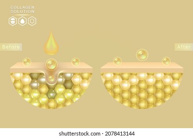 Hyaluronic acid before and after skin solutions ad, gold collagen serum drops with cosmetic advertising background ready to use, illustration vector.