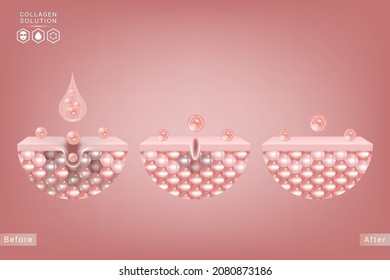 Hyaluronsäure vor und nach Hautlösungen und rosafarbenem Kollagen-Serum sinkt mit kosmetischem, gebrauchsfertigem Werberhintergrund, Vektorgrafik.