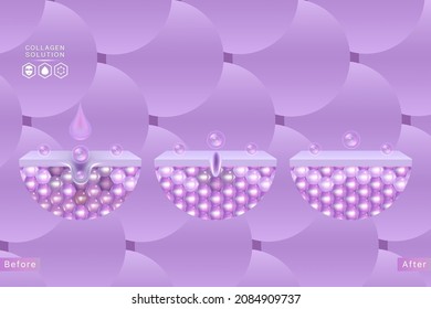 Hyaluronic acid before and after skin solutions ad, purple collagen serum drops with cosmetic advertising background ready to use, illustration vector.