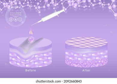 Hyaluronic acid before and after skin solutions ad, purple collagen serum drops with cosmetic advertising background ready to use, illustration vector.