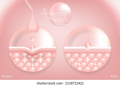 Hyaluronic acid before and after skin solutions ad, pink collagen serum drops with cosmetic advertising background ready to use, illustration vector.	