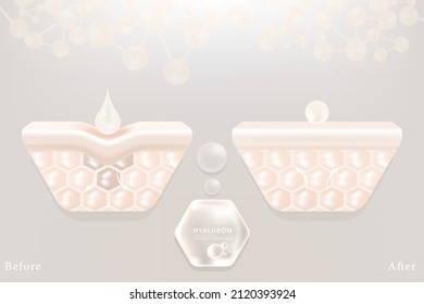 Hyaluronic acid before and after skin solutions ad, white collagen serum drops with cosmetic advertising background ready to use, illustration vector.	