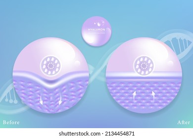 Hyaluronic acid before and after skin solutions ad, purple collagen serum drops with cosmetic advertising background ready to use, illustration vector.