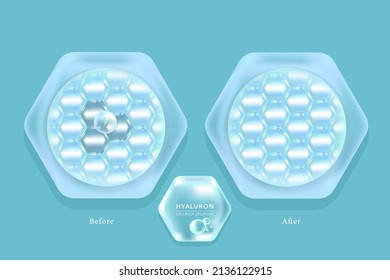 Hyaluronic acid before and after skin solutions ad, blue collagen serum drops with cosmetic advertising background ready to use, illustration vector.