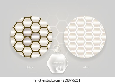 Hyaluronic acid before and after skin solutions ad, white collagen serum drops with cosmetic advertising background ready to use, illustration vector.