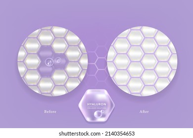 Hyaluronic acid before and after skin solutions ad, purple collagen serum drops with cosmetic advertising background ready to use, illustration vector.