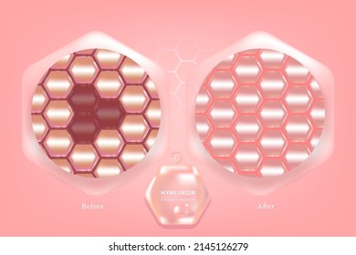 Hyaluronic acid before and after skin solutions ad, pink collagen serum drops with cosmetic advertising background ready to use, illustration vector.