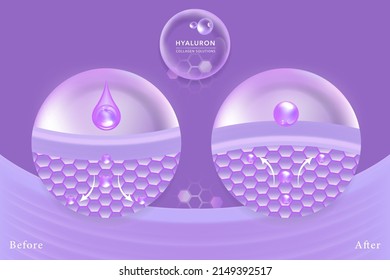 Hyaluronic acid before and after skin solutions ad, purple collagen serum drops over skin cells with cosmetic advertising background ready to use, illustration vector.	