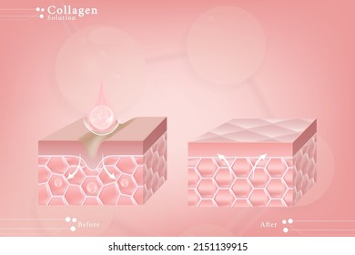 Hyaluronsäure vor und nach Hautlösungen fällt rosafarbenes Kollagen-Serum über rosafarbene Hautzellen mit kosmetischem, gebrauchsfertigem Werbetext, Vektorgrafik.	