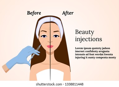 Hyaluronic acid filler injection. Anti-aging concept. Cosmetologically procedures. Before and after vector illustration. Beauty salon. Rejuvenating mesotherapy.  Facial wrinkles smoothing.