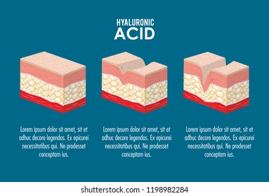 hyaluronic acid filler injection infographic