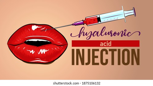 Hyaluronic acid filler injection or mesotherapy procedures. Beautiful red female lips. Cosmetology moisturizing procedures and beauty concept banner. Vector hand drawn illustration for advertisement.
