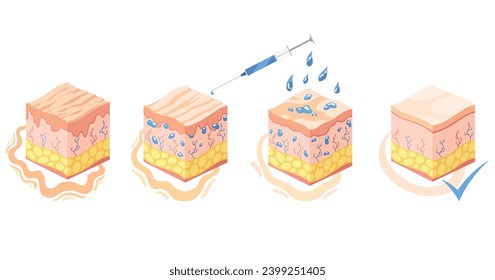 Hyaluronic acid isometric. Profile view cubes representing skin structure layers icons. Subcutaneous tissue, dermis and epidermis anatomical structure. Cartoon vector illustration isolated on white