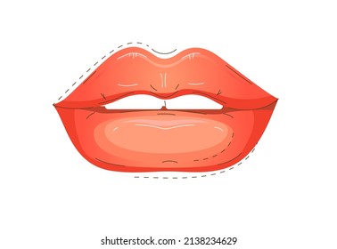 Hyaluronic acid lip injections illustration in iconic style. Vector illustration with detailed anatomical zones infographic in red and white colours. Medical, cosmetological and anti-aging concept.