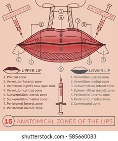 Hyaluronic acid lip injections scheme. Vector illustration with detailed anatomical zones infographic in pink and brown colours. Medical, cosmetological and anti-aging concept.