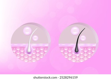 Hyaluronic acid and Niacinamide before and after gray hair and skin solutions ad, pink collagen serum drops into skin cell with cosmetic advertising background ready to use, illustration vector.
