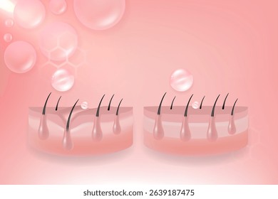 Hyaluronic acid and Niacinamide before and after hair and skin solutions ad, pink collagen serum drops into skin cell with cosmetic advertising background ready to use, illustration vector.	