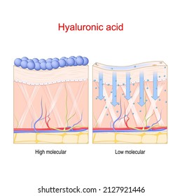 Hyaluronic Acid. Penetration In The Skin Of Low And High Molecule Hyaluronic Acid. Vector Poster About Skin Care And Anti-aging Therapy