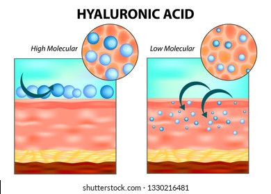 Hyaluronic acid in skin. Low molecular and High molecular.