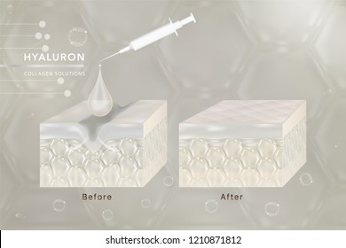Hyaluronic acid skin solutions ad, white collagen serum drop with cosmetic advertising background ready to use, syringe in 3d illustration.	