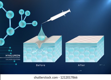 Hyaluronic acid skin solutions ad, blue collagen serum drop with cosmetic advertising background ready to use, syringe in 3d illustration.	