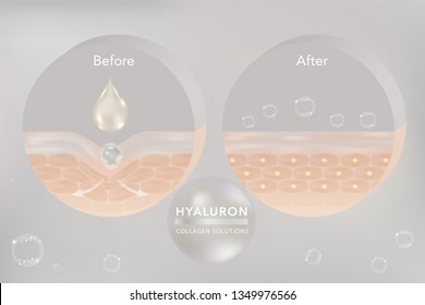 Hyaluronic acid skin solutions ad, white collagen serum drop with cosmetic advertising background ready to use. illustration vector.