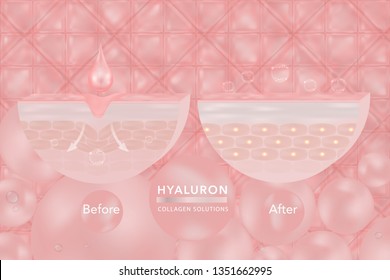 Hyaluronic acid skin solutions ad, pink collagen serum drop with cosmetic advertising background ready to use. illustration vector.	
