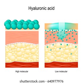 Hyaluronic acid. Hyaluronic acid in skin-care products. Low molecular and High molecular. Difference