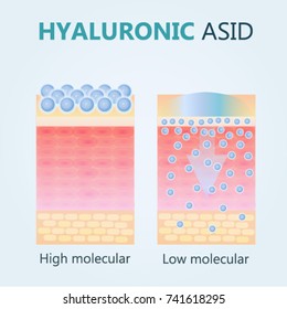 Hyaluronic acid. Hyaluronic acid in skin-care products. Low molecular and High molecular.