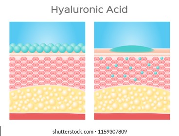 Hyaluronic Acid Vector / Skin