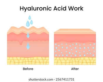 Hyaluronic acid work on skin