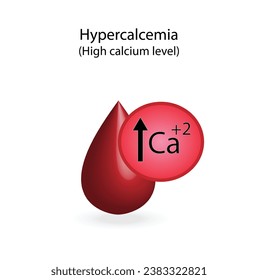 Hyperkalzämie, hoher Calciumspiegel im Plasma. Kalziumüberschuss und Defizit Elektrolytstörungen, Bluttropfen, Wissenschaftliches Design. Vektorgrafik.