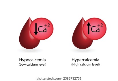 hipercalcemia, niveles plasmáticos elevados de calcio e hipocalcemia, bajos niveles plasmáticos de calcio. Exceso de calcio y trastornos electrolíticos deficitarios, gota de sangre, Diseño científico. Ilustración vectorial.