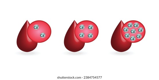 Hyperkalzämie, hoher Calciumspiegel im Plasma und Hypokalzämie, niedriger Calciumspiegel im Plasma. Kalziumüberschuss und Defizit Elektrolytstörungen, Bluttropfen, Wissenschaftliches Design. Vektorgrafik.