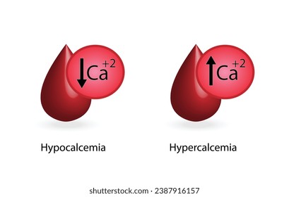 hipercalcemia, niveles plasmáticos elevados de calcio e hipocalcemia, bajos niveles plasmáticos de calcio. Exceso de calcio y trastornos electrolíticos deficitarios, gota de sangre, Diseño científico. Ilustración vectorial.