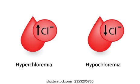 Hyperchloremie, hoher Chloridspiegel und Hypochloremie, niedriger Chloridspiegel im Plasma. Chlorid-Überfluss-und Defizit-Elektrolytstörungen, Bluttropfen, Wissenschaftliches Design. Vektorgrafik.
