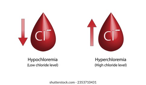 Hyperchloremie, hoher Chloridspiegel und Hypochloremie, niedriger Chloridspiegel im Plasma. Chlorid-Überfluss-und Defizit-Elektrolytstörungen, Bluttropfen, Wissenschaftliches Design. Vektorgrafik.
