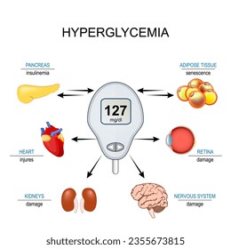 hiperglucemia. Resistencia a la insulina. Relación entre células senescentes, niveles altos de azúcar en sangre y complicaciones de la Diabetes mellitus. Ilustración del vector
