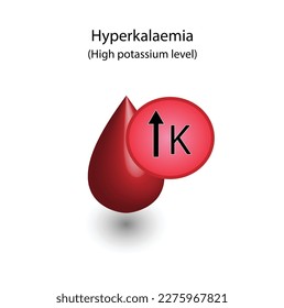 Hiperpotasemia, niveles plasmáticos elevados de potasio. Exceso de potasio K, trastornos electrolíticos, tubo de análisis de sangre, Diseño científico. Ilustración vectorial.