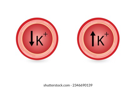 Hyperkalaemia, high plasma potassium level and Hypokalaemia, low plasma potassium level. Potassium K excess and deficit electrolyte disorders, blood test tube, Scientific design. Vector illustration.