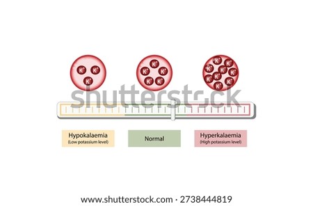 Hyperkalaemia, high plasma potassium level and Hypokalaemia, low plasma potassium level. Potassium K excess and deficit electrolyte disorders, blood test tube, Scientific design. Vector illustration.